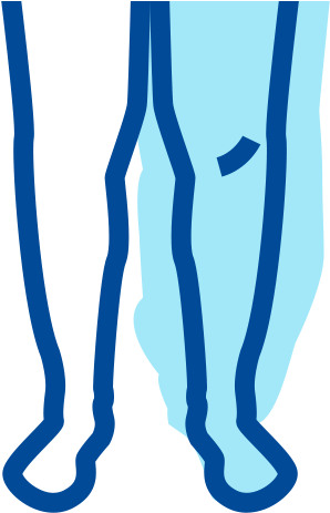 Lymphedema Treatment Clipart (715x462), Png Download