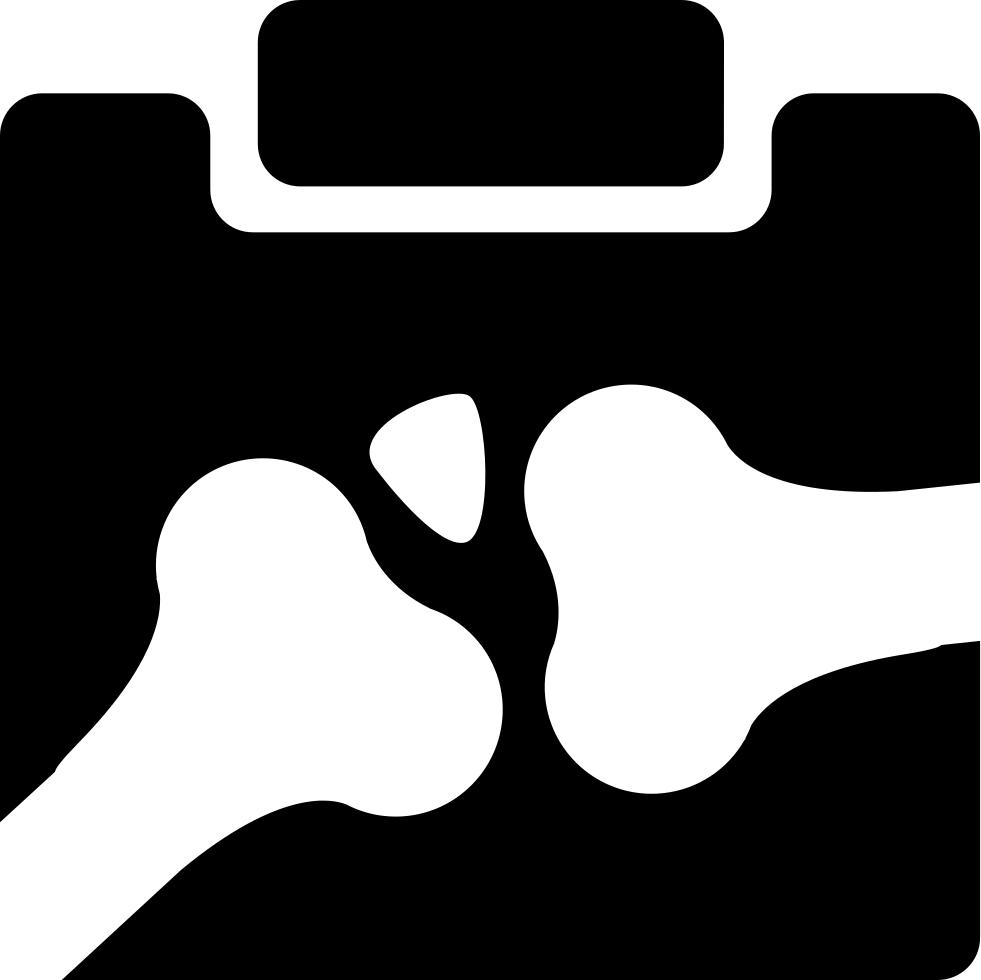 X-ray Of Bones Comments - Iconos De Rayos X Clipart (981x980), Png Download