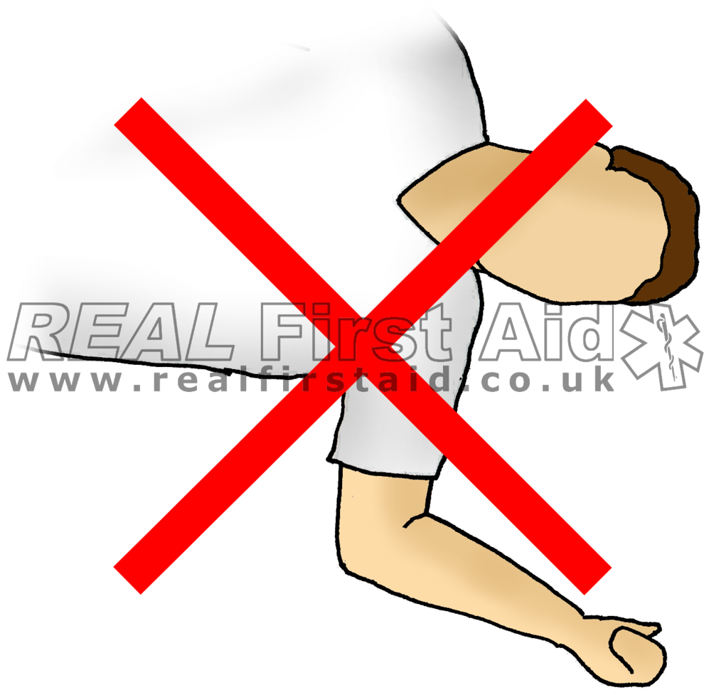 Casualty Positioning Real First Aid Sap Arms - Dada Clipart (1000x982), Png Download