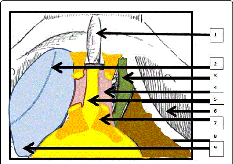 Anatomical Relationships Between The Bladder And The - Urinary Bladder Clipart (769x539), Png Download