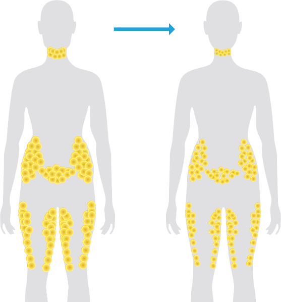 Normal Weight Loss - Fat Cells Are Located Clipart (557x598), Png Download