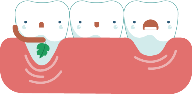 Headache Clipart Dental Pain - Gums - Png Download (822x595), Png Download