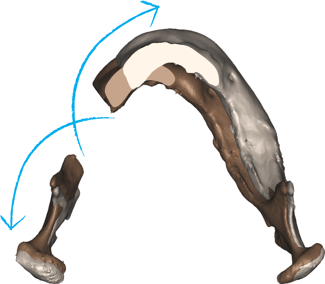 Matching - Surgery Clipart (1293x1145), Png Download