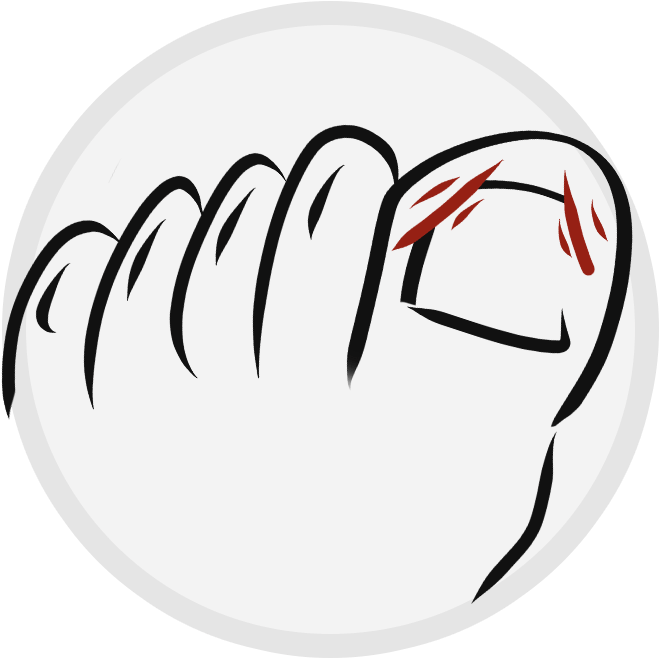 Ingrown Nails - Illustration Clipart (794x772), Png Download