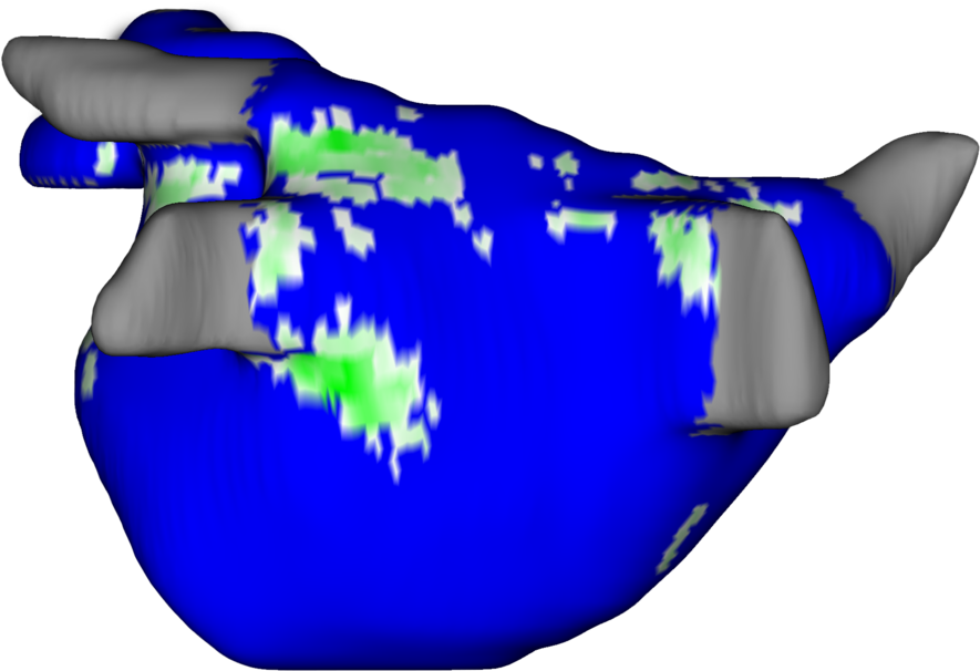 We Are Transforming And Personalizing The Treatment Clipart (1000x654), Png Download