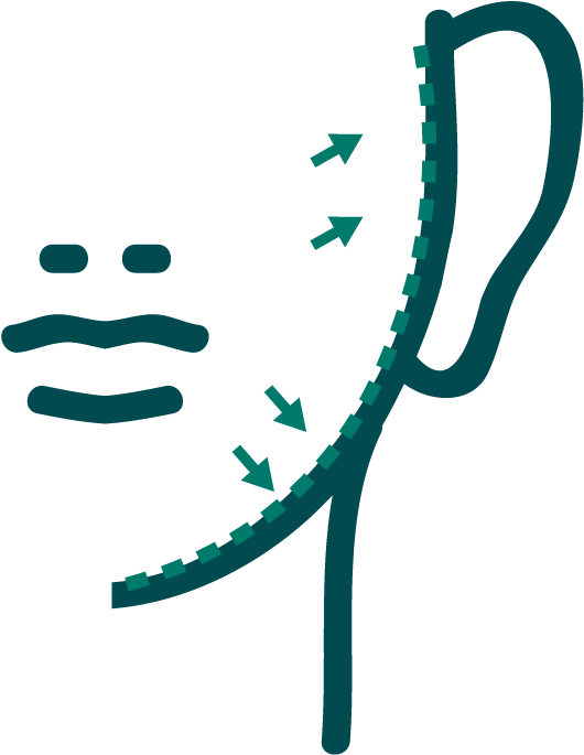 Face Lift2-01 - Botulinum Toxin Clipart (793x742), Png Download