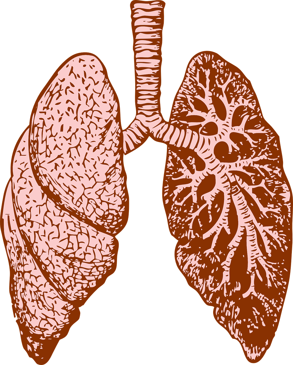 Study Uncovers Link Between Bacterium And Lung Transplant - Dealing With Bronchitis: Overcoming Bronchitis And Clipart (1027x1280), Png Download