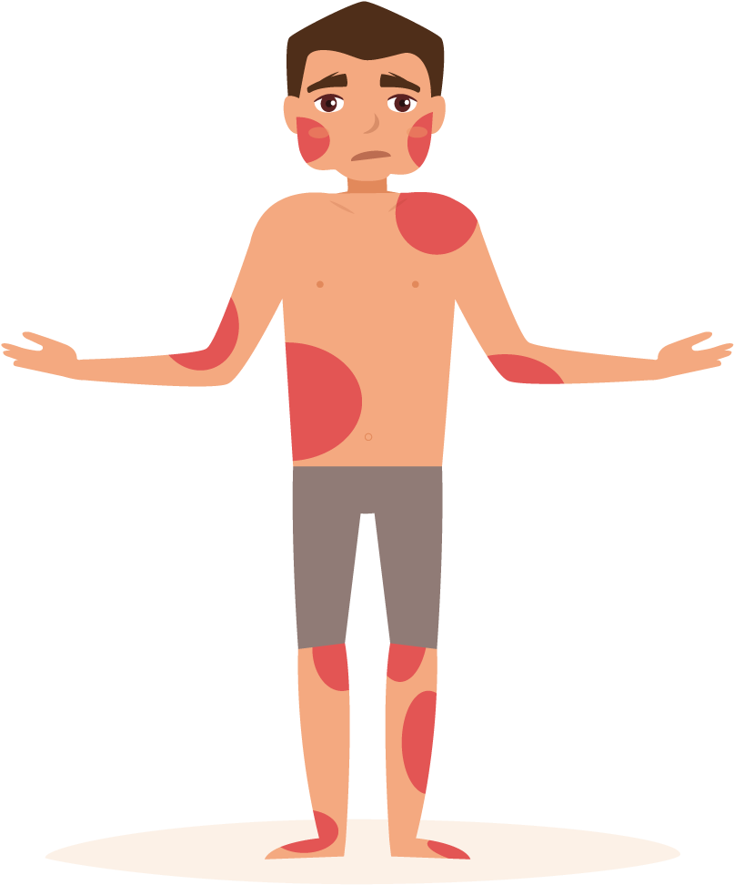 Eczema Eczema Clip Art Png Download Full Size Clipart (1564049