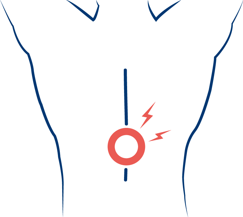 Best Mattress For Back Pain - Back Pain Clipart (801x716), Png Download