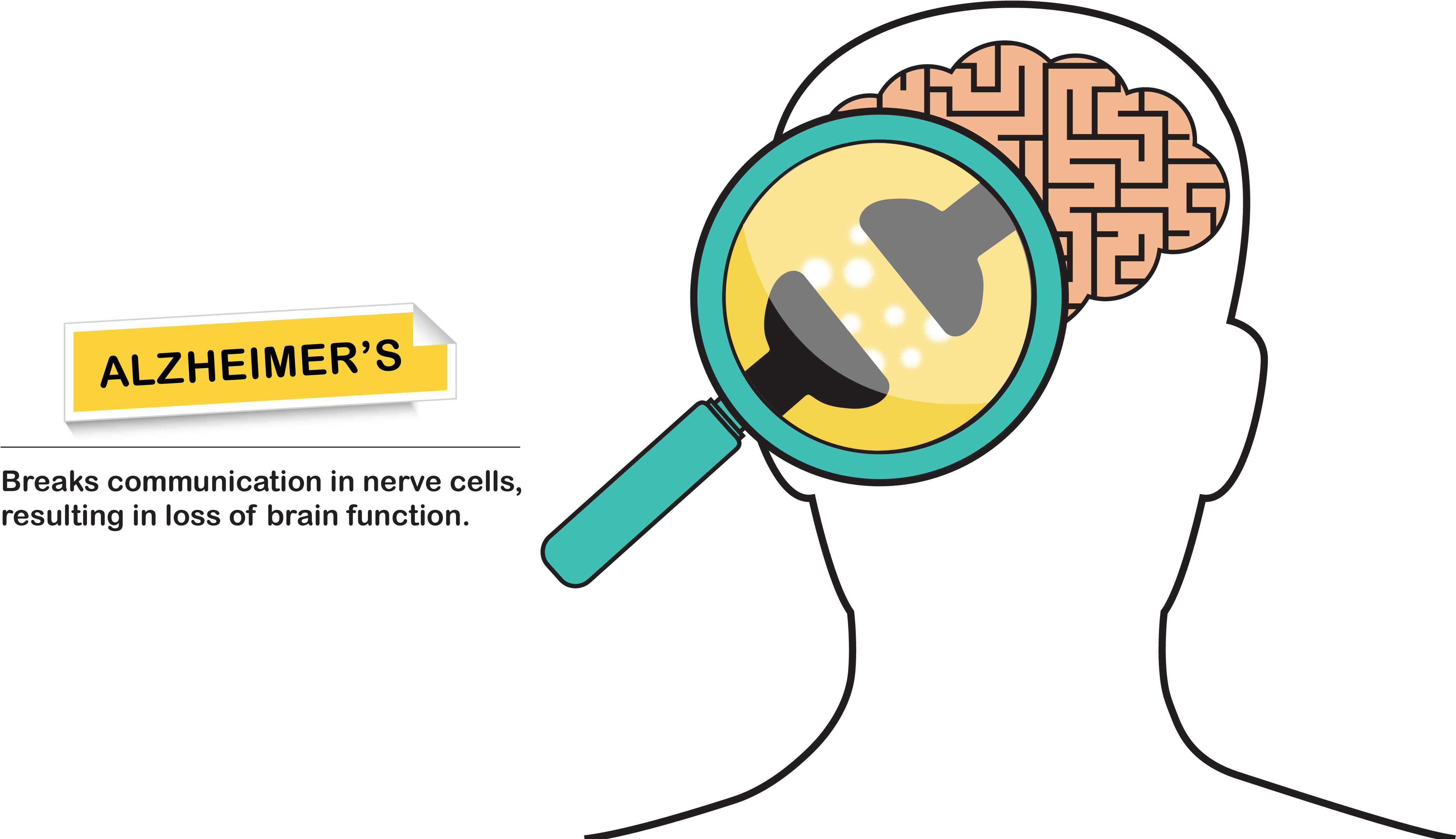 Alzheimer's Neurons Clipart (5001x2618), Png Download