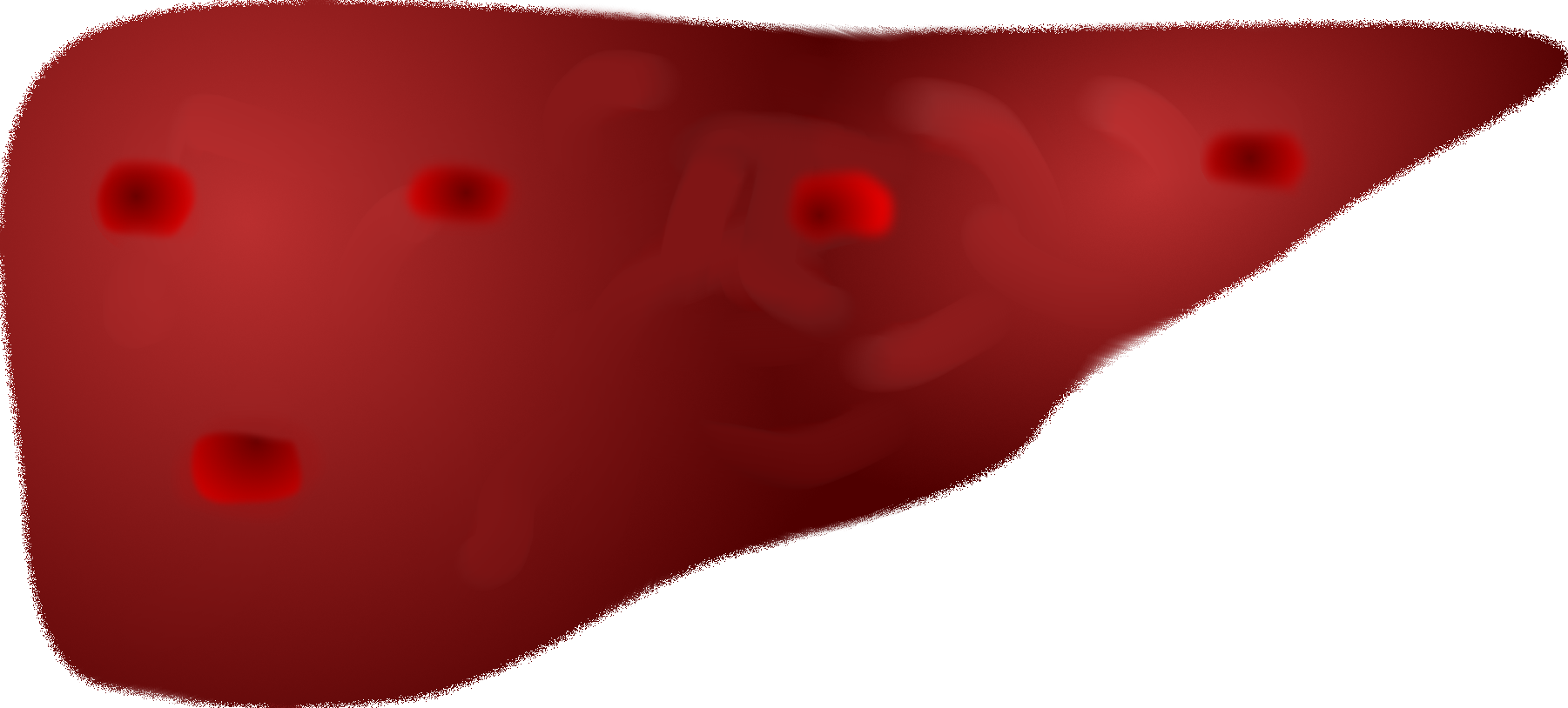 Metastatic Liver - Illustration Clipart (1801x814), Png Download