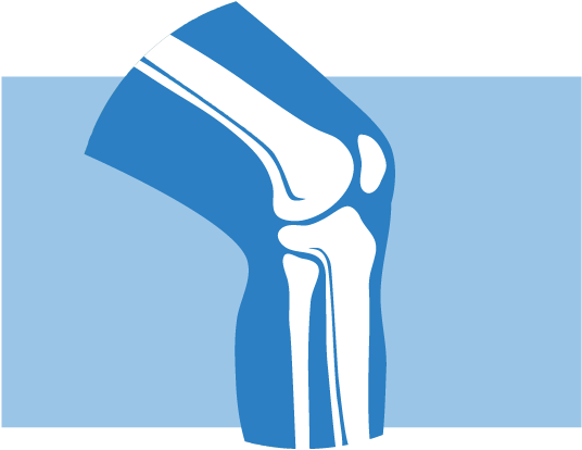 Knee Pain Treatments Clipart (719x435), Png Download