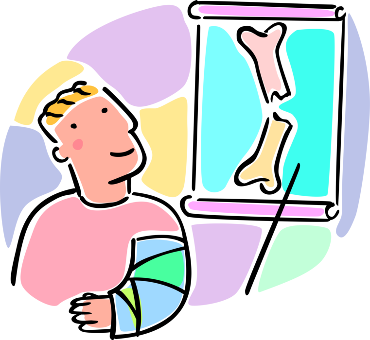 Download Vector Illustration Of Young Patient Boy With Broken Broken