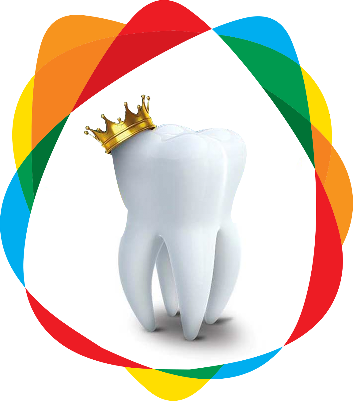 Dental Crowns Ideal Smile Crown - Crown Clipart (1152x1311), Png Download
