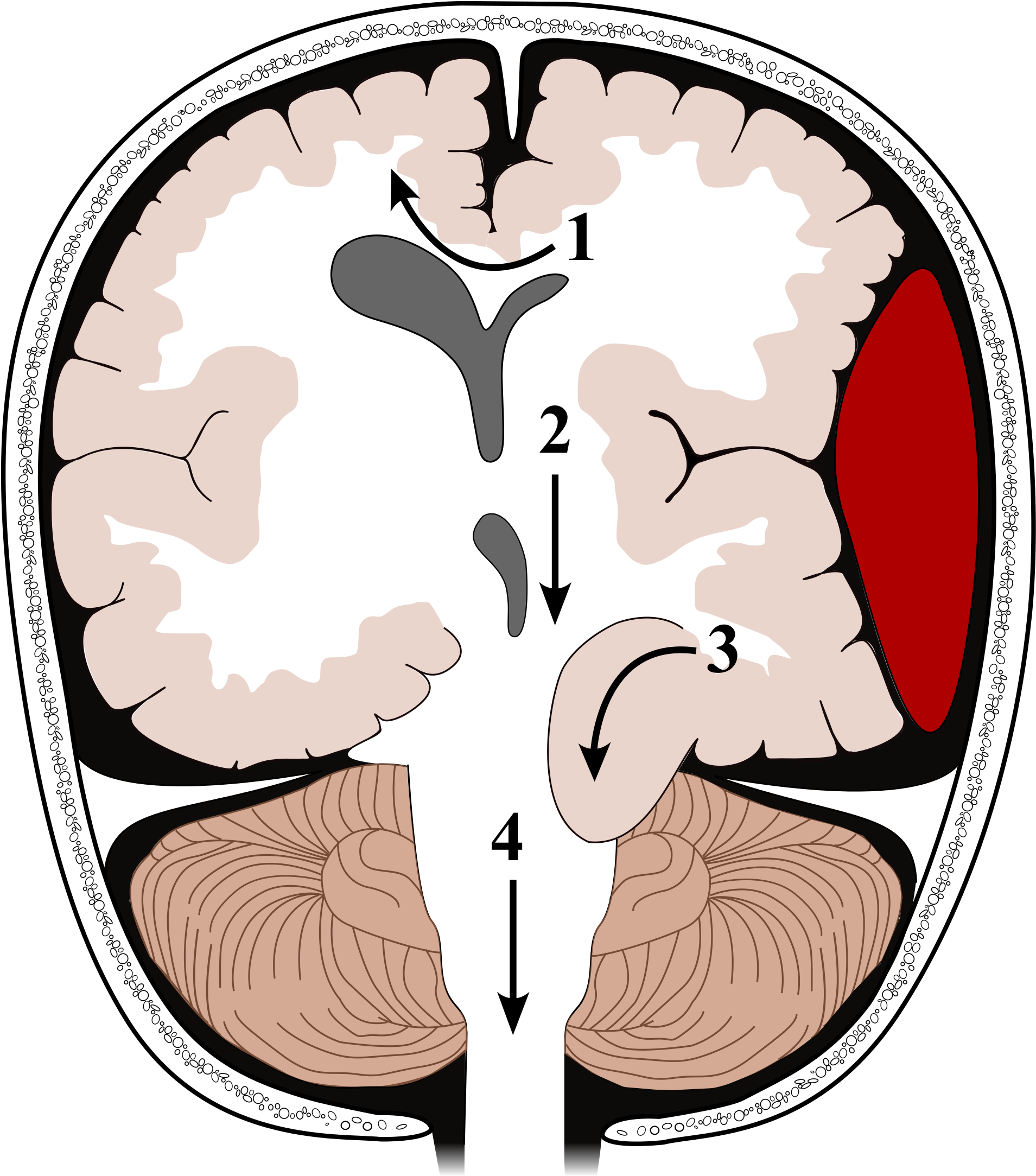 Open - Types D Engagement Cérébral Clipart (2000x2210), Png Download