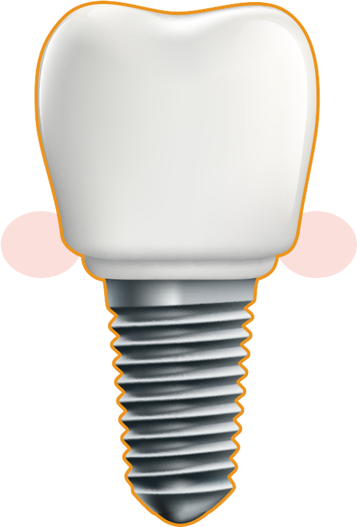 Dental Implant - Illustration Clipart (558x764), Png Download