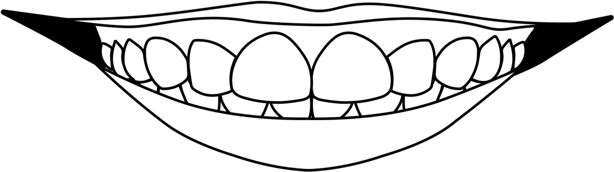 Gum Shows Too Much Clipart (1200x622), Png Download