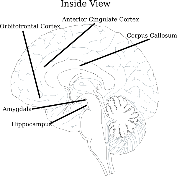 Brain Clipart (600x595), Png Download