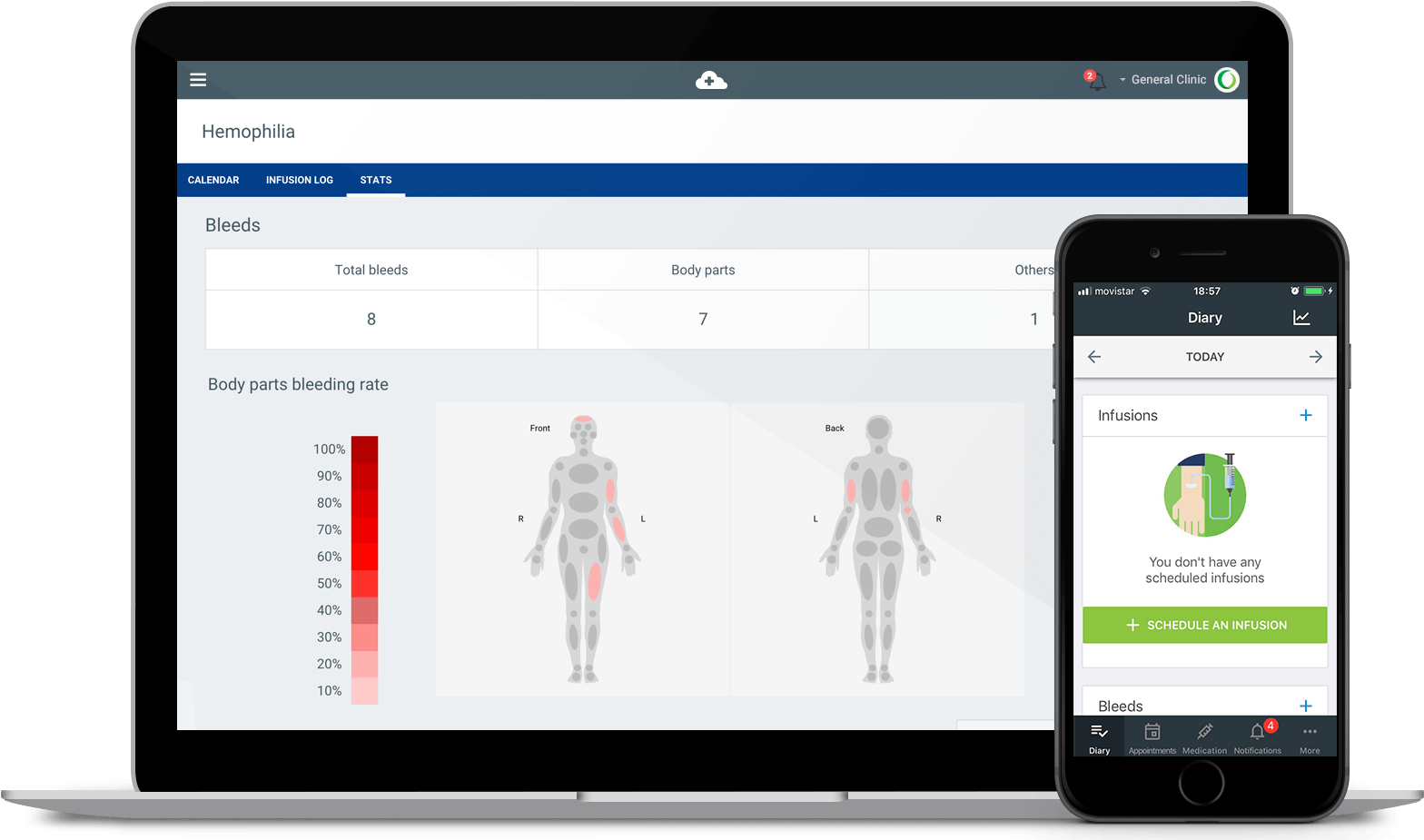 Medtep Hemophilia - Medtep Inc. Clipart (1630x949), Png Download