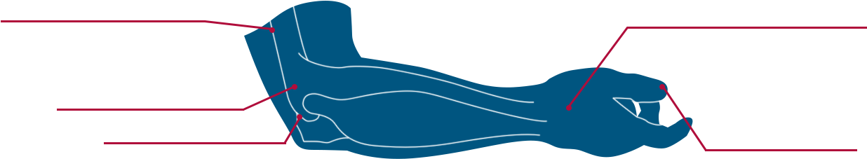 Rotator Cuff Tendonitis » Clipart (1412x349), Png Download