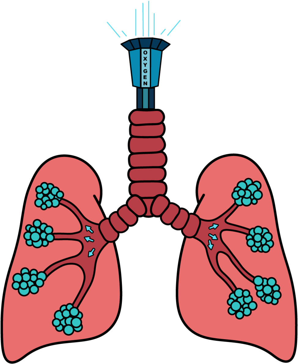 Drop Tower Lung Ride To Go Along With The Theme Park - Lung Clipart (1000x1204), Png Download