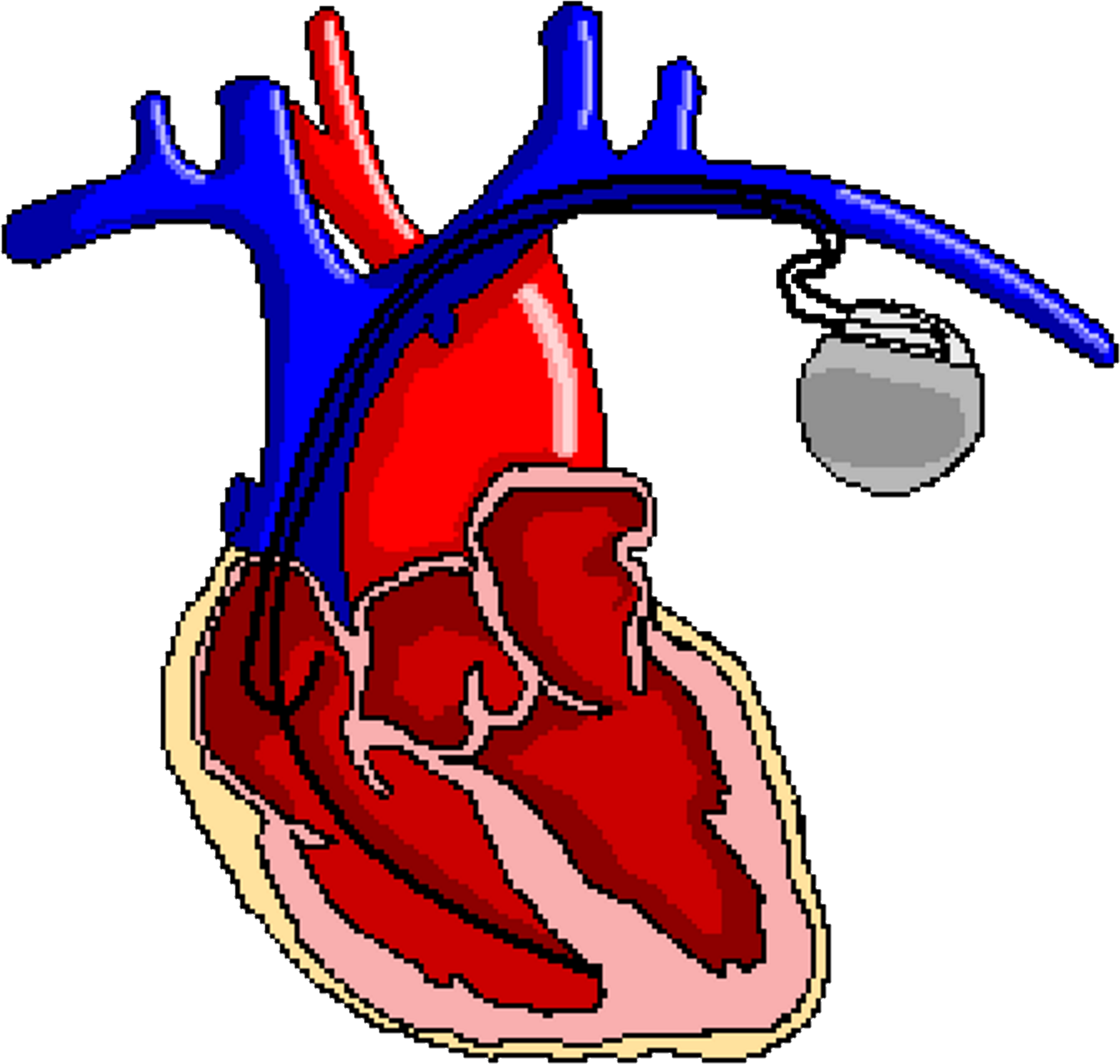 Ppg Change Complications - Portable Network Graphics Clipart (3300x3036), Png Download