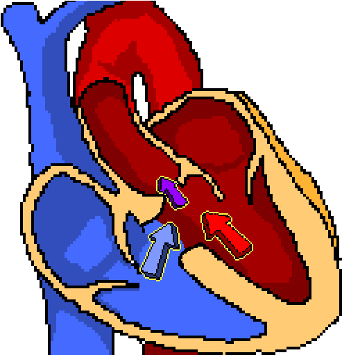 Banner Library Library Bradycardia The Physiologist - Tetralogy Of Fallot Clipart (648x510), Png Download