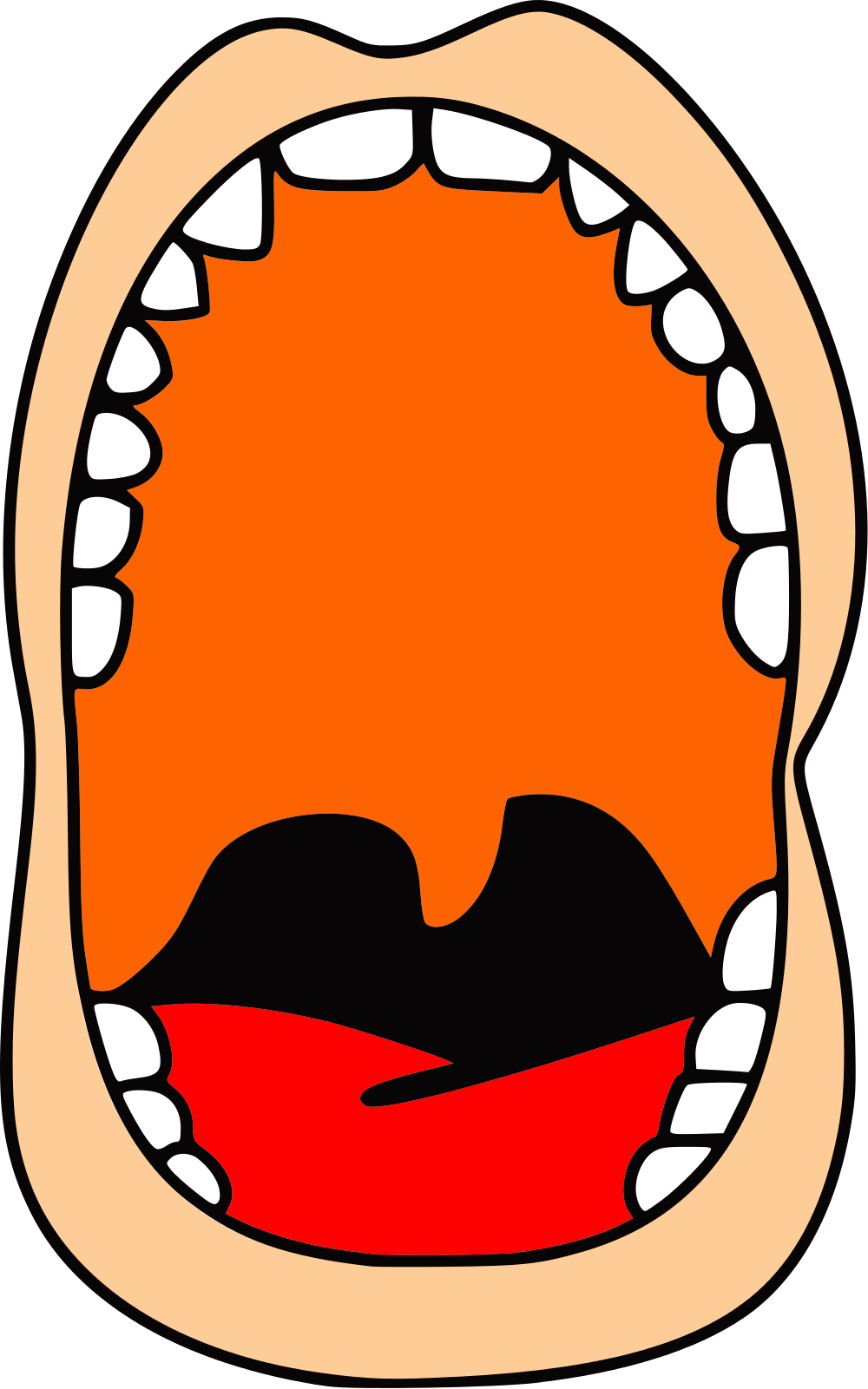 Open - Pharyngeal Flap Surgery Clipart (1000x1601), Png Download