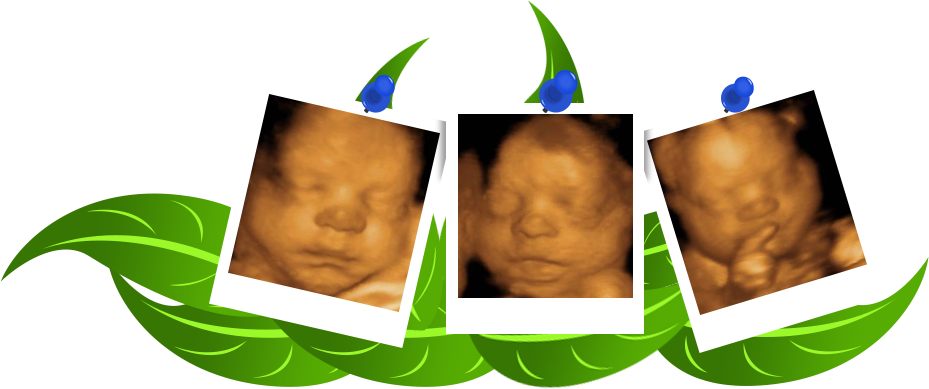 Deluxe Package Clipart (929x389), Png Download