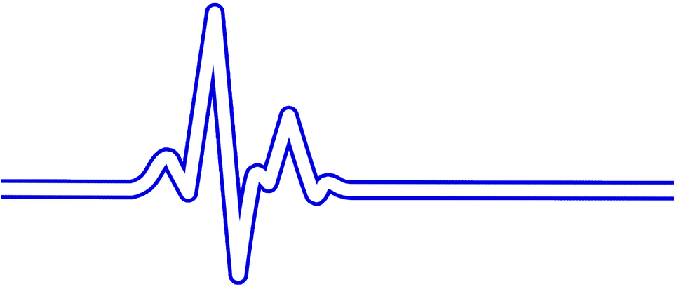 Heart Rate Bpm Ecg U00b7 Free Image On Pixabay - Ekg With Transparent Background Clipart (960x720), Png Download
