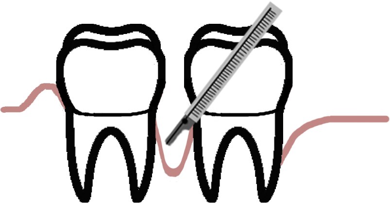 Periodontal Disease Is The Second Largest Cause Of - Periodontology Clipart (960x480), Png Download