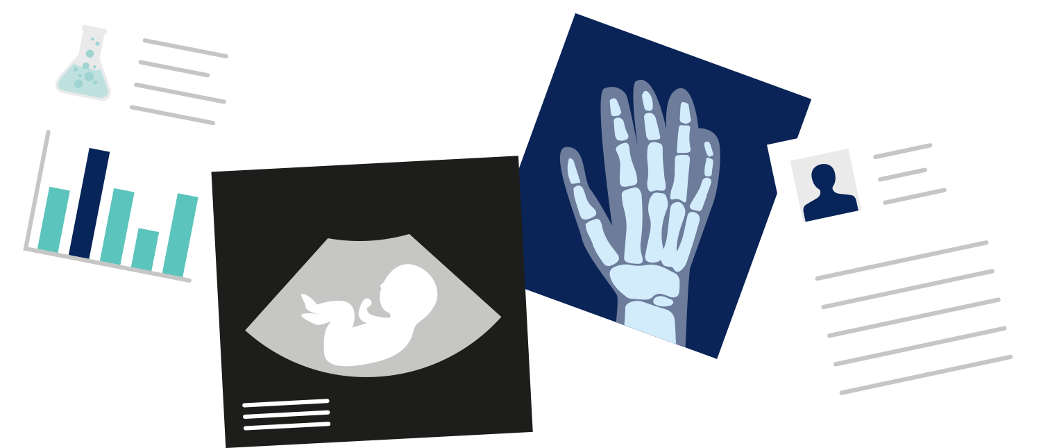 Collect, Understand And Monitor Data Clipart (1500x645), Png Download