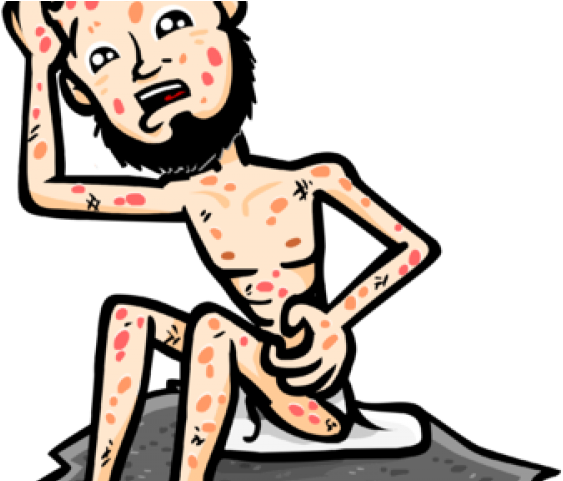 Boils Cliparts - Png Download (640x480), Png Download