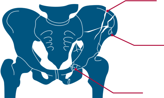 Type C » Clipart (818x427), Png Download