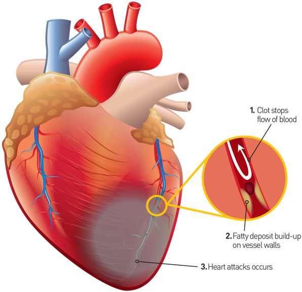 Some Organic Acids Present In Coriander, Such As Oleic Clipart (640x620), Png Download