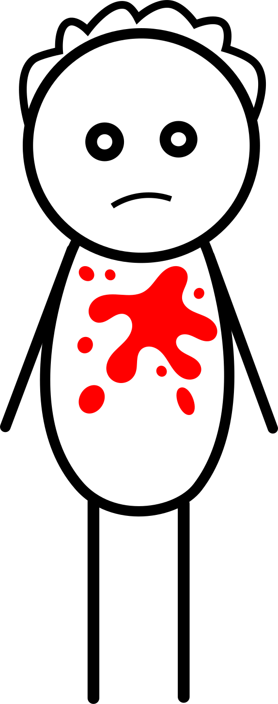 Red Herring As A Type Of Indirect Discourse Clipart (574x1452), Png Download