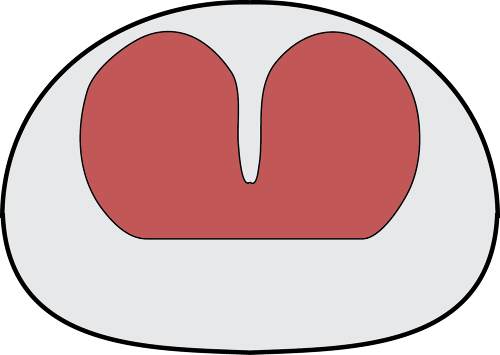 Select Zone Clipart (1000x709), Png Download