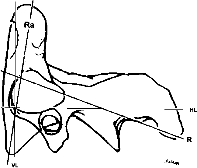 Description Of Measurements Taken From The Lateral Clipart (648x552), Png Download