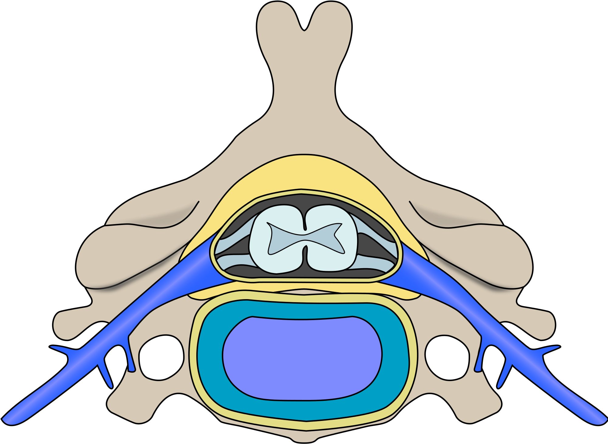 File Cervical Vertebra Blank Wikimedia Commons Open - Spinal Polio Clipart (2000x1480), Png Download