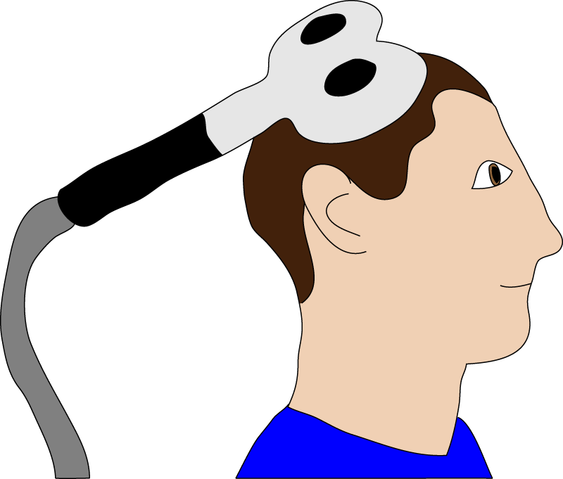 Figure A Tms Coil Placed On A Participant's Head Clipart - Full Size