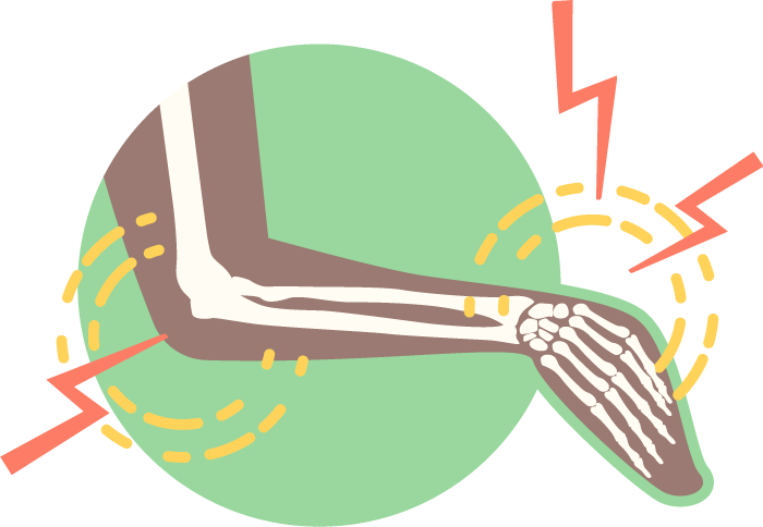 Hand, Wrist & Elbow Conditions Clipart (700x484), Png Download