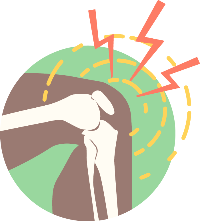 Knee-conditions Clipart (700x772), Png Download