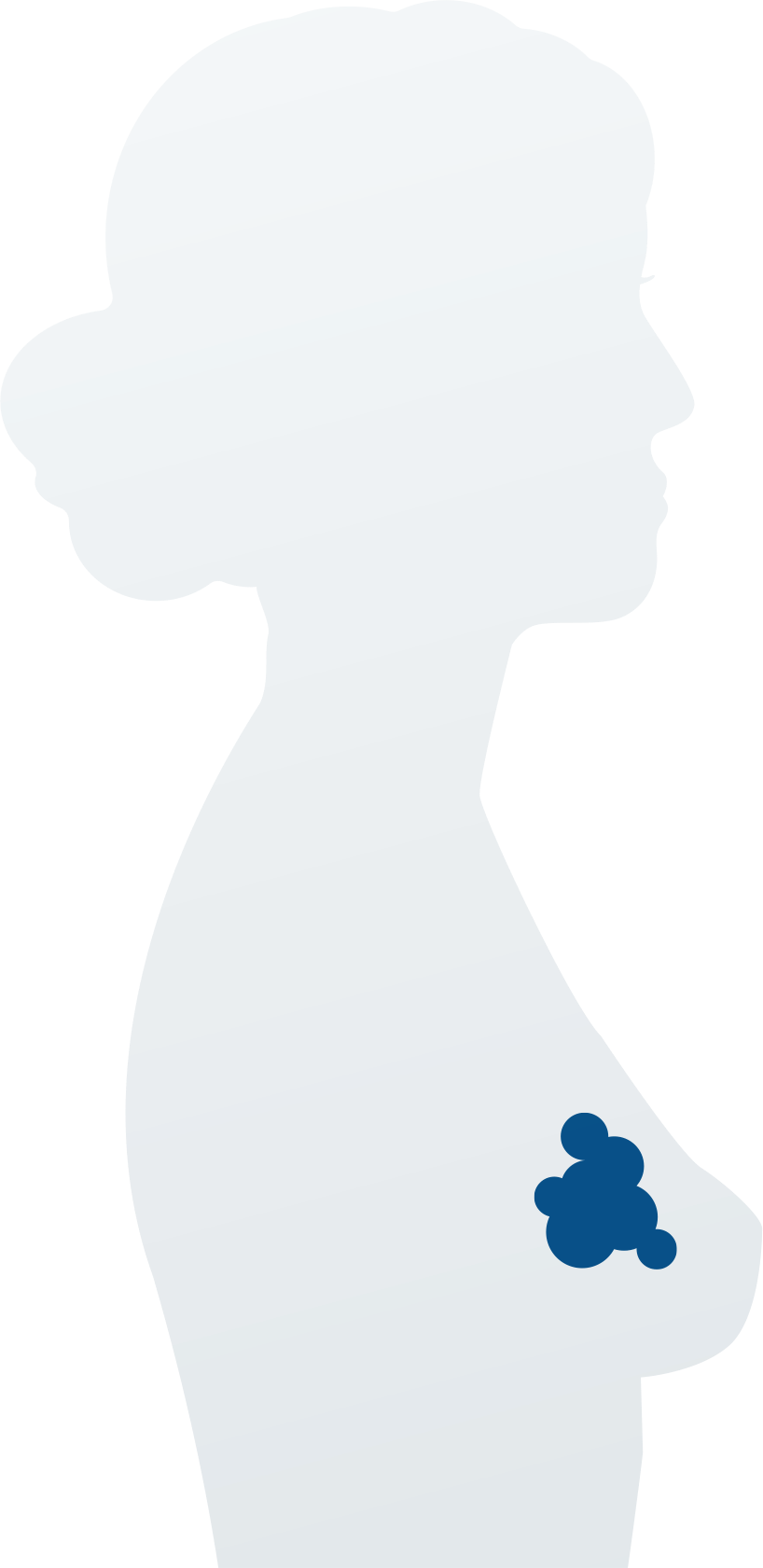 early-breast-cancer-means-the-cancer-has-not-spread-clipart-full-size