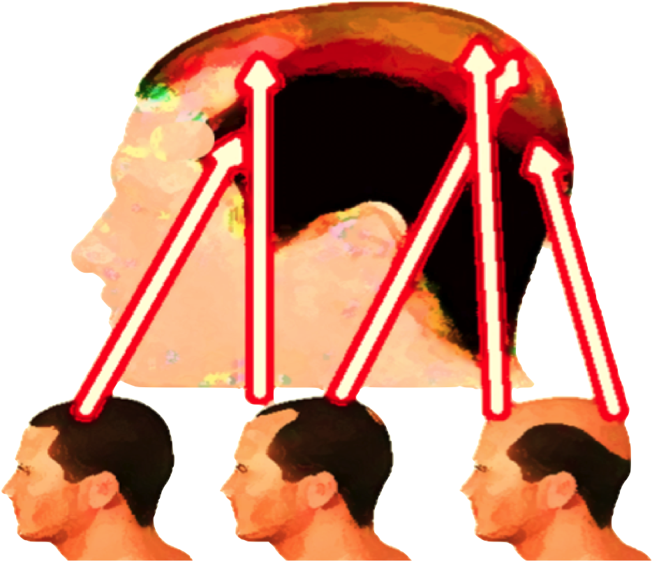 Http - //www - Endhairloss - Eu The Best All Natural Clipart (984x815), Png Download