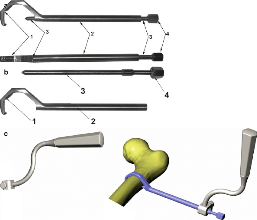 24 Extracortical Clamp Device For Diaphyseal Fi Xation Clipart (850x727), Png Download