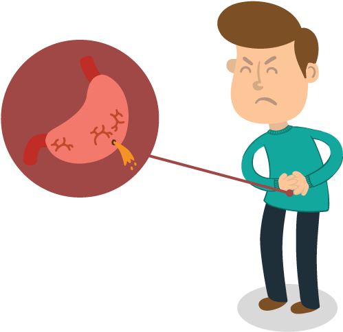 Ayurvedic Treatment For Gastric Ulcer At Central India Clipart (842x595), Png Download