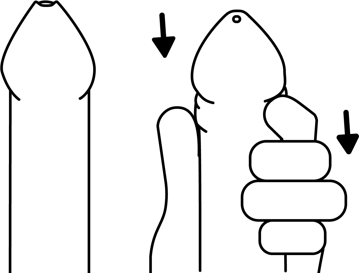 How Do I Use A Condom Clipart (1650x1275), Png Download