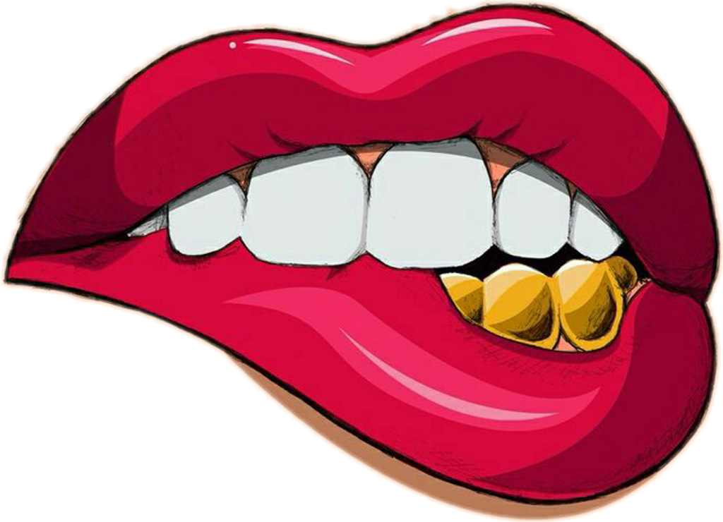 Tooth With Braces Clipart - Png Download (663x480), Png Download
