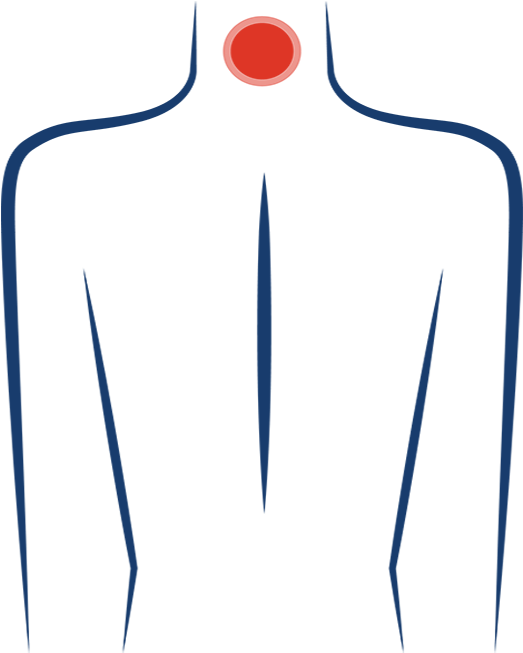 Neck Pain New 600 Clipart (600x809), Png Download