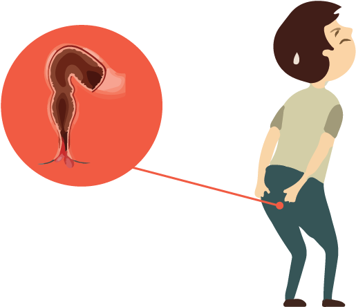 Suffering From Prolapse Of Rectum Come To Parijatak Clipart (842x595), Png Download